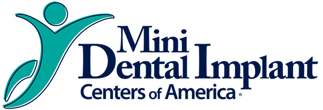 Mini Dental Implants in Lehigh Acres, FL